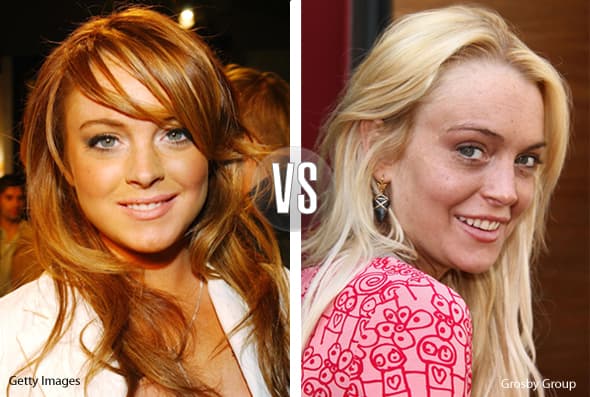 El colágeno, las drogas y la fiesta loca arruinaron el hermosos rostro de Lindsay Lohan.