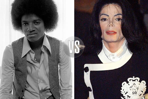 Michael Jackson es conocido como el ‘Rey del Pop’, pero podría haber sido llamado el ‘Rey de la Metamorfosis', pues tenía tantas cirugías que era irreconocible.