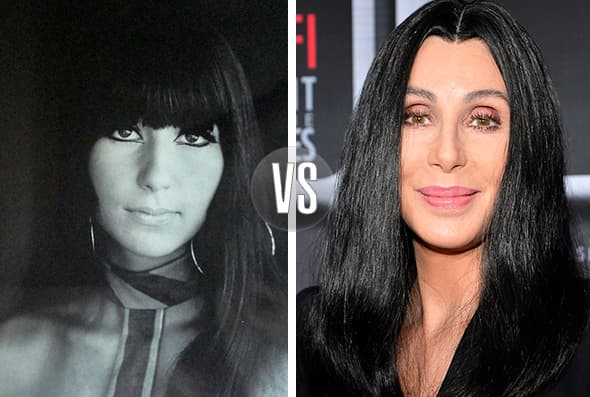 Si de cirugías estéticas se trata, uno de los máximos referentes es la cantante Cher. **Fotos: Twitter y Getty Images.