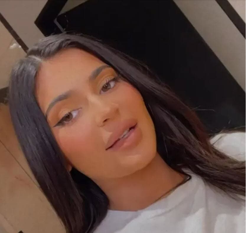 Las imágenes de sus labios causaron críticas por parte de algunos de sus seguidores, tal como ha sucedido en las últimas horas. 
<br>