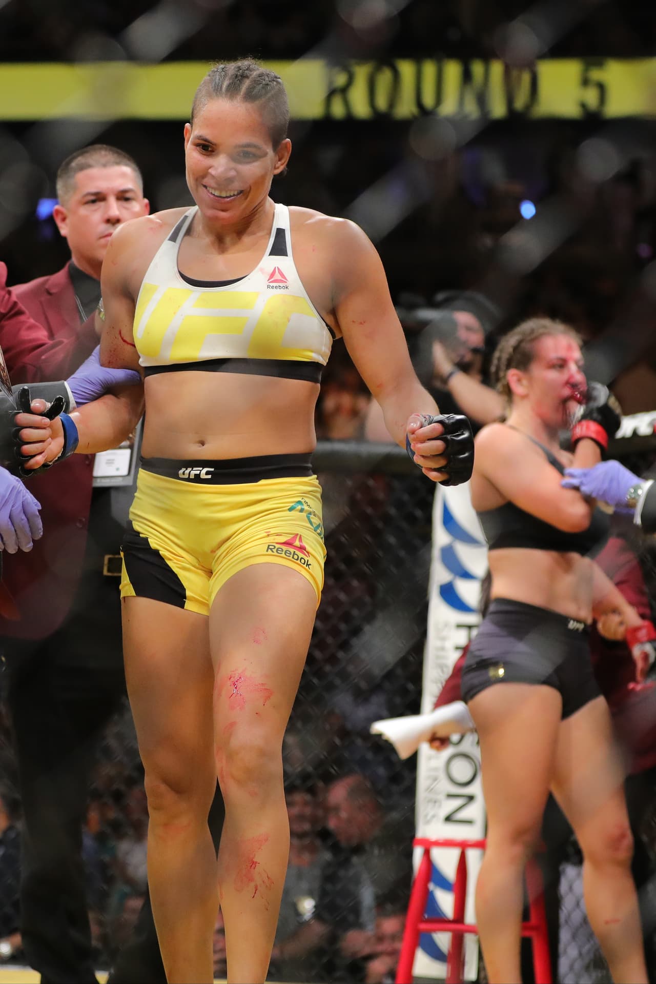 Ahí se acabó la pelea y Amanda Nunes estrena cinturón de campeona.