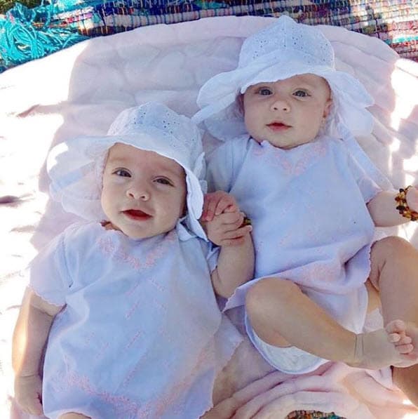 Aunque son muy parecidas, las gemelas sí tienen pequeñas diferencias físicas.