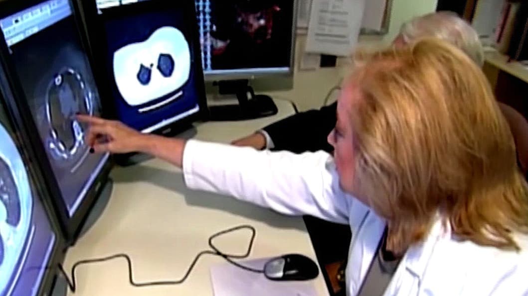 Tratamiento contra el cáncer antes de las 3:00 PM podría alargar la vida casi un año