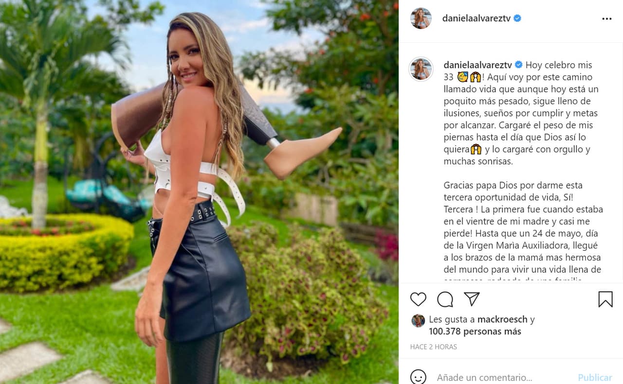 En medio de esto, y con la prótesis cargada al hombro, la colombiana escribió en Instagram un sincero mensaje para conmemorar un año más en este mundo: "¡Aquí voy por este camino llamado vida que 
<b><a href="https://www.instagram.com/p/CPQuJo7JtcD/" target="_blank">aunque hoy está un poquito más pesado</a></b>, sigue lleno de ilusiones, sueños por cumplir y metas por alcanzar!". 
<br>