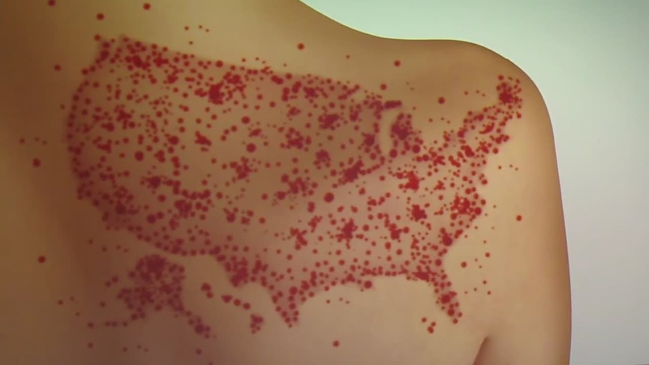 EEUU podría perder status ante la OMS de país libre de sarampión