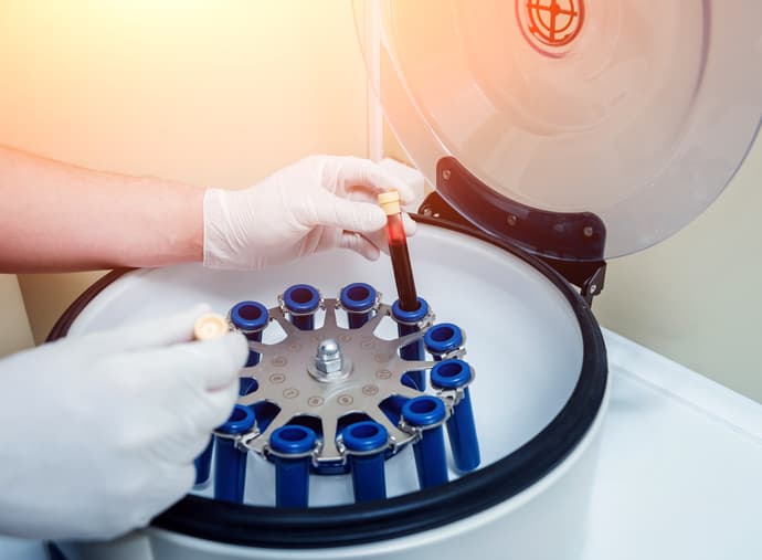 <b>¿Son seguros? Depende</b>. El riesgo viene dado por los protocolos que se sigan para manipular la sangre. “Es esencial que la sangre que remuevan del cuerpo se mantenga estéril para evitar el riesgo de infección”, 
<a href="https://www.aad.org/public/skin-hair-nails/anti-aging-skin-care/facials" target="_blank">explica</a> la Asociación Estadounidense de Dermatología en su página web. Advierten que los centros deben usar el mismo proceso que los centros de transfusión de sangre para asegurarse de que no haya problemas, como ocurrió en el caso reciente de dos personas en Nuevo México que contrajeron VIH en el mismo spa luego de hacerse este facial. El proceso está contraindicado si sufres de hepatitis C, VIH o SIDA, enfermedades cardiovasculares o cáncer de piel en el área a tratar.