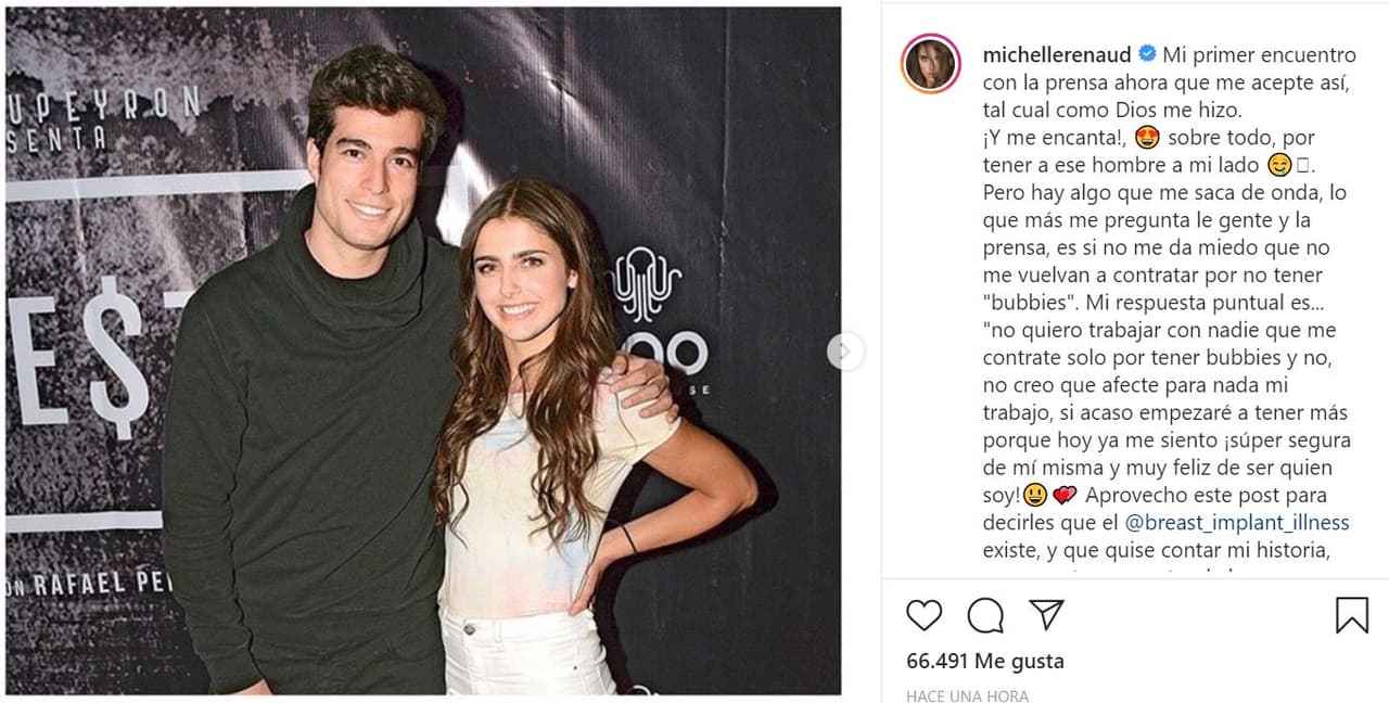 Este 4 de febrero, Michelle Renaud tuvo un encuentro con la prensa, el primero desde que se aceptó "así, tal cual como Dios me hizo".