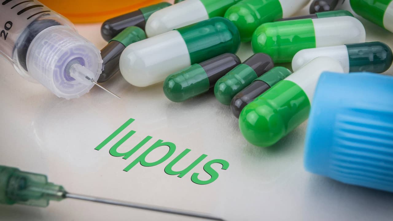 Qué es el Lupus y las recomendaciones de Dr. Juan para tratar esta enfermedad