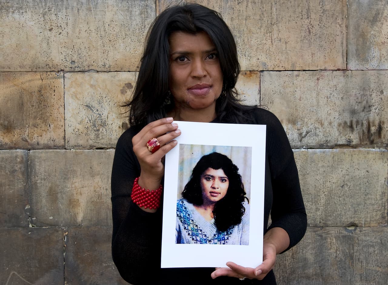 Gina Potes fue una de las primeras en denunciar un ataque de ácido hace 20 años. Casi 30 cirugías después, quiere usar sus cicatrices como una herramienta para ayudar a otras mujeres que han sufrido este tipo de violencia.