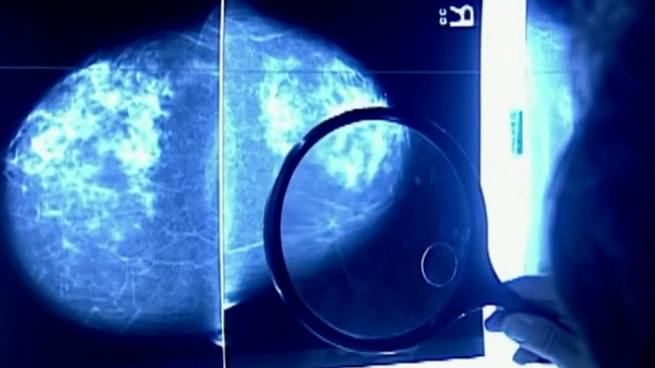 Papa León XIV es diagnosticado con cáncer de pulmón: ¿Qué sigue para el pontífice? Experto analiza