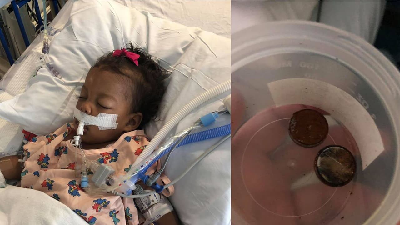 Salima Sulemana, de 1 año, está en la unidad de cuidados intensivos en el Children's Hospital de Atlanta, luego de ingerir dos pilas