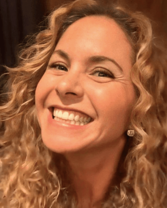 Sin embargo, ha desechado esa idea gracias a su hija 
<a href="https://www.univision.com/famosos/hija-lucero-y-mijares-criticas-fotos">Lucero Mijares</a>, quien le ha dicho que si lo hace eso la cambiará y “ya no vas a ser como mi mamá”. Por lo tanto, la cantante prefiere seguir compartiendo imágenes al natural, en donde se ve su hermosa sonrisa.