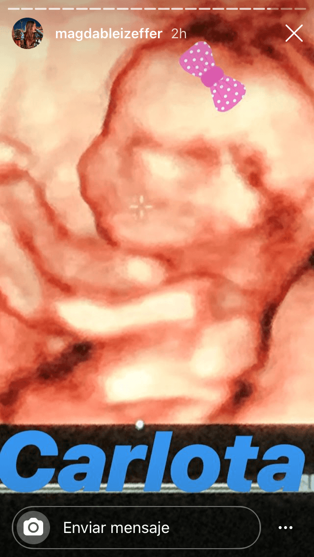 Durante el matutino 
<b><a href="https://www.univision.com/shows/hoy" target="_blank">Hoy</a></b> aseguró que a su edad "no se espanta" de ser padre por tercera ocasión junto a su pareja Magda Bleizeffer. 
<br>