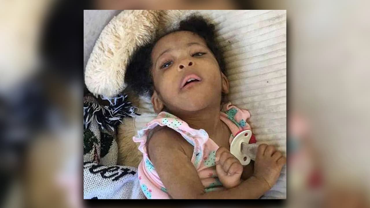 Kylie L. Mickens, de 5 años, llegó inconsciente al Northeast Georgia Medical Center Braselton. La niña pesaba alrededor de 7 libras y fue trasladada en avión a Children's Healthcare of Atlanta en Scottish Rite.