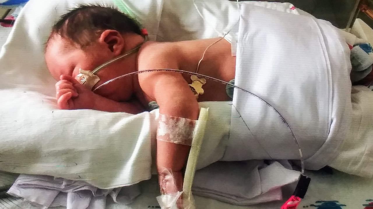 El bebé salió del hospital varias semanas después.
<br>