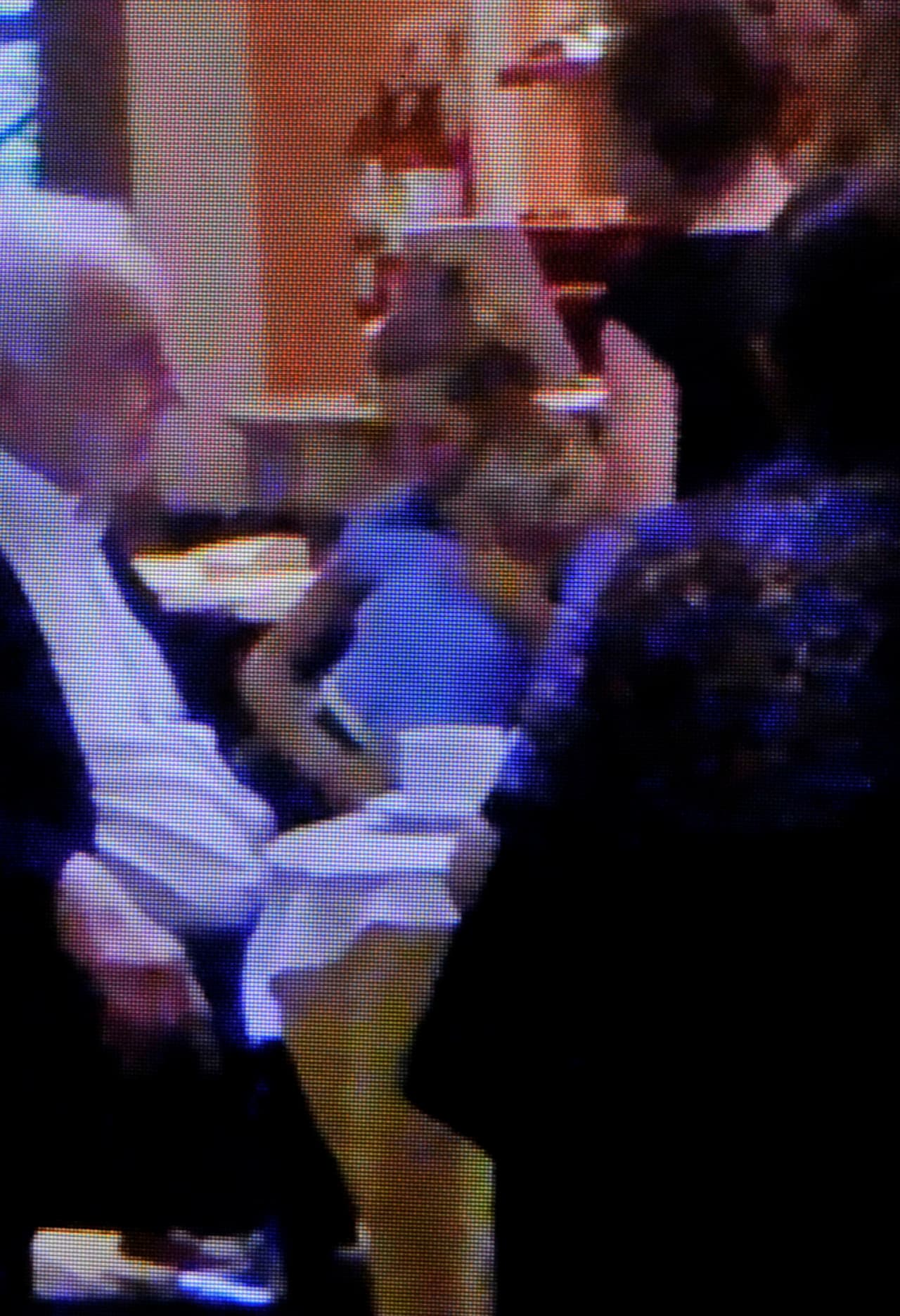 Se sabe que el niño ya fue operado cuatro veces con anestesia total