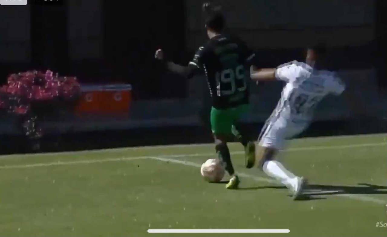 ¡Fuertes imágenes! Jugador de Santos sufre impactante lesión