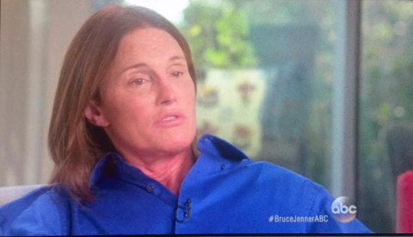 A las horas siguientes de despertarse de la anestesia, pensó que tenía una infección por tanto dolor, pero no fue así.