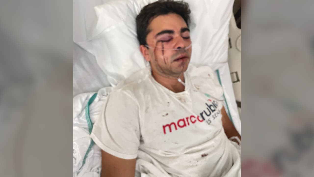 La víctima necesita una cirugía facial reconstructiva.