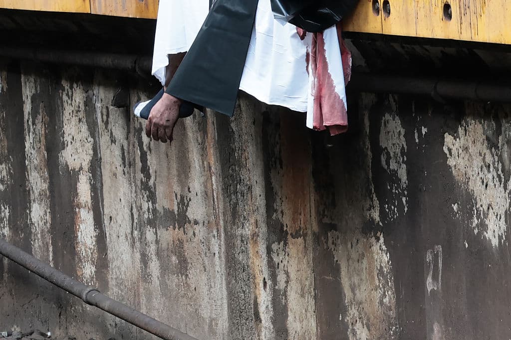 La policía encontró a la víctima con trauma severo en la cabeza.