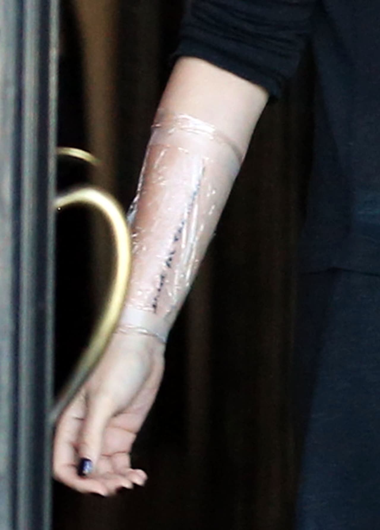 ¡Se lo hizo a lo largo de todo el brazo derecho!