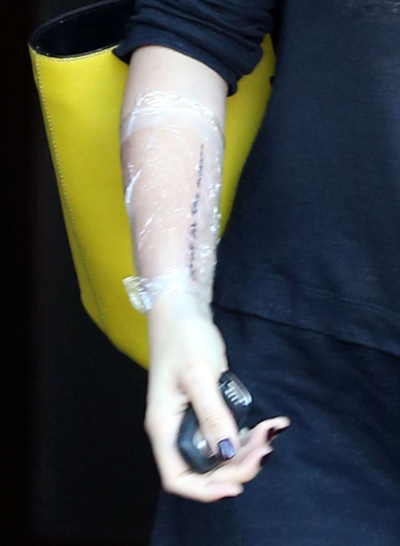 Esa zona es una de las más sensibles del cuerpo, debido a que no le da el sol de manera directa.