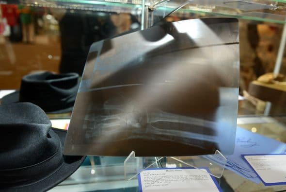 De Elvis también se subastó una radiografía de su mano, por ella pedían entre $4,000 y $6,000, ¿la habrías comprado?