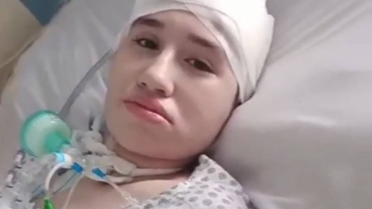 Le quitaron parte del cráneo tras un accidente y lleva meses esperando una cirugía reconstructiva