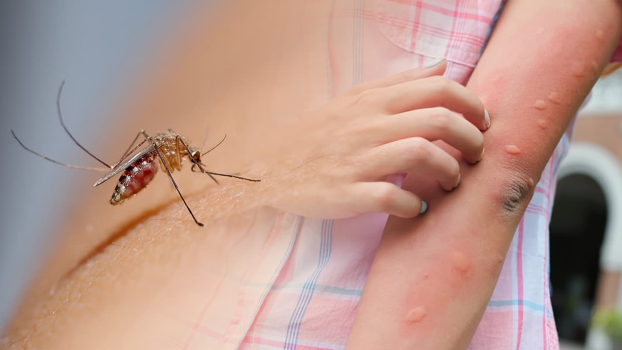 Dengue en Los Ángeles: Salud Pública confirma tres casos locales y pide tomar medidas preventivas