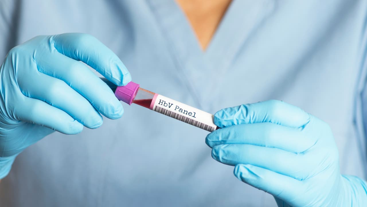 Alerta sanitaria: caso de hepatitis A en restaurante de Little Tokio; lo que debes saber