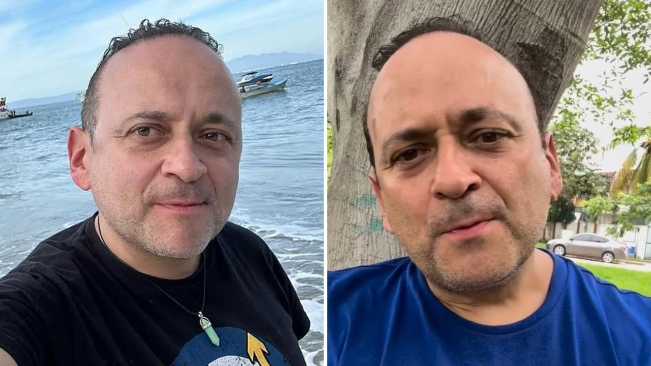 ¿Lalo España está perdiendo el oído? El actor revela la enfermedad que tiene y que lo hizo deprimirse