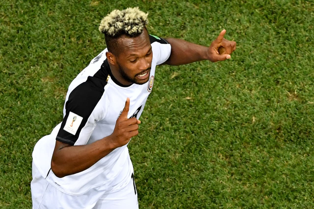 Las puntas decoloradas de Kendall Waston de Costa Rica.