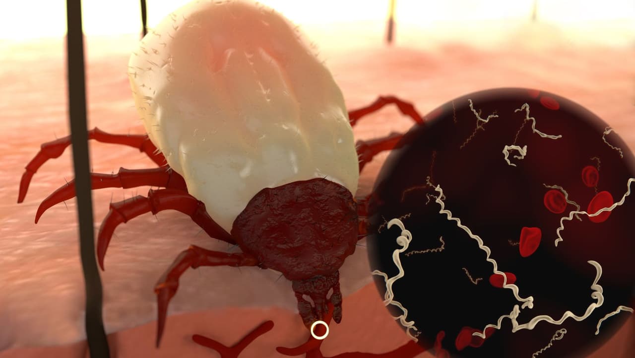 4. A medida que la enfermedad avanza, se vuelve más grave y, por lo tanto, se presenta una fuerte afectación neurológica, como confusión y convulsiones.