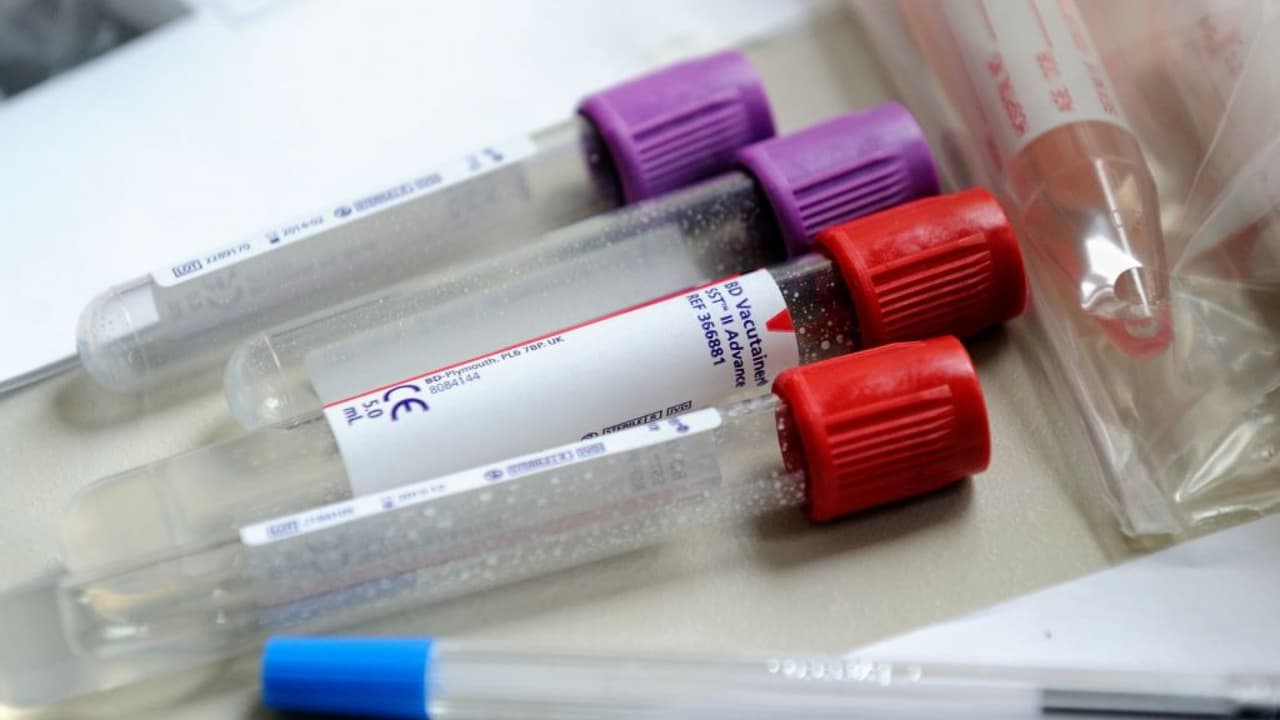 Esta escuela en Los Ángeles está ofreciendo pruebas gratuitas de detección del coronavirus