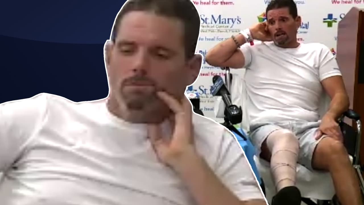 Hombre de Florida cuenta cómo fue atacado por un cocodrilo que casi le arranca la pierna