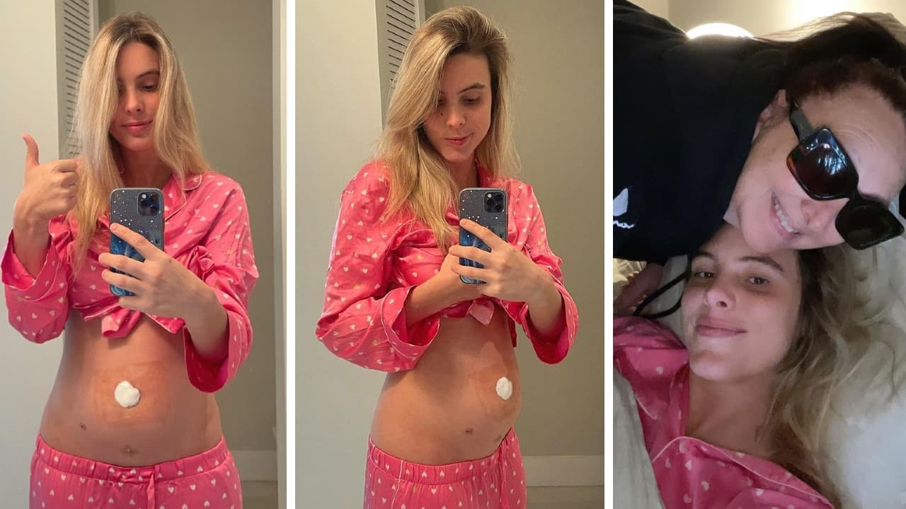 Lele Pons muestra su abdomen hinchado.