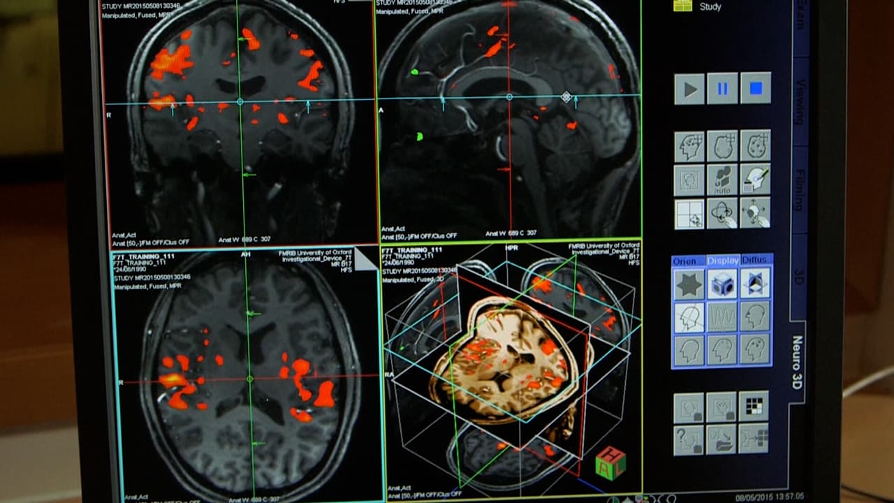 ¿Un chip en el cerebro? Estas son las preocupaciones éticas que hay con los implantes de Neuralink