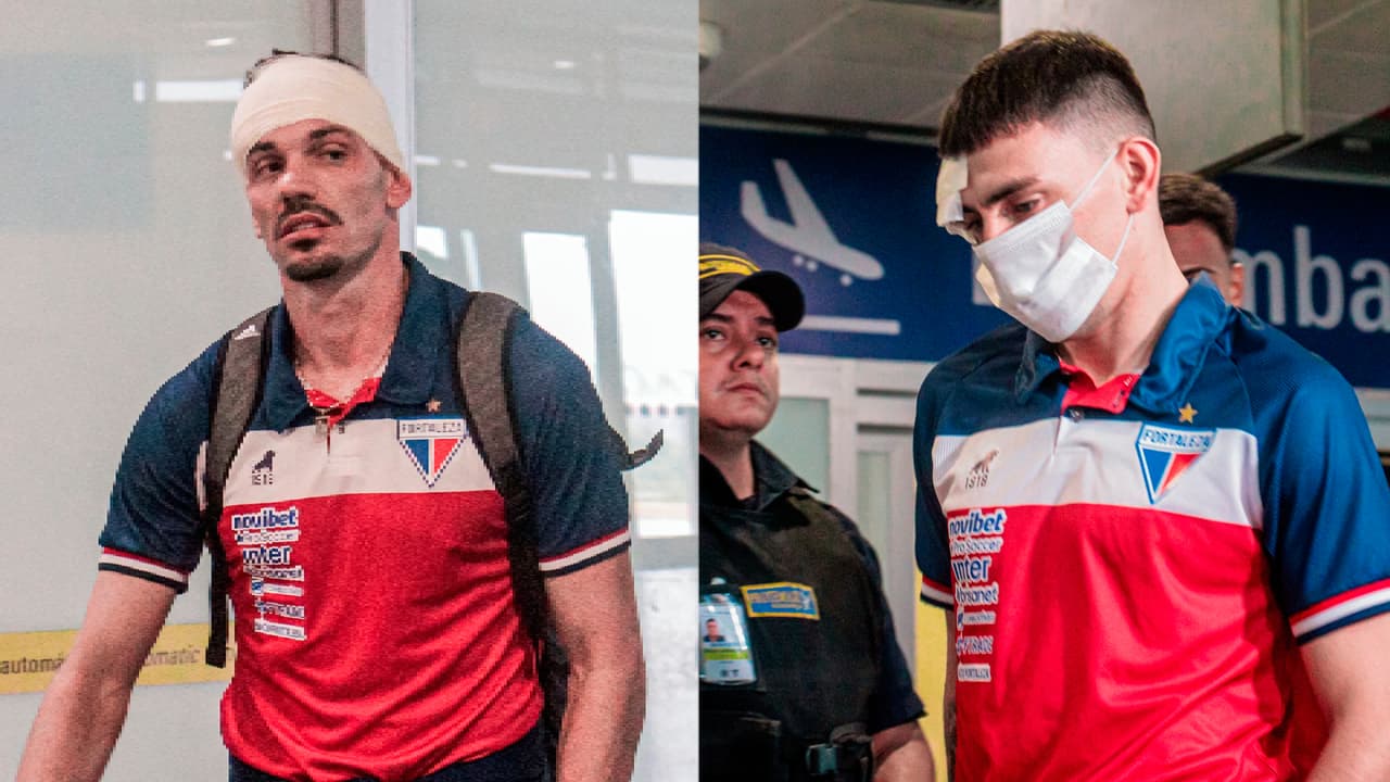 Futbolistas de Fortaleza resultan heridos tras ser agredidos por aficionados