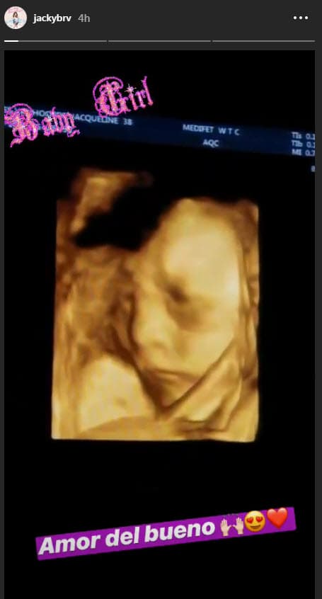 Esta es la primera vez que Jacky deja ver un ultrasonido de sus niñas.