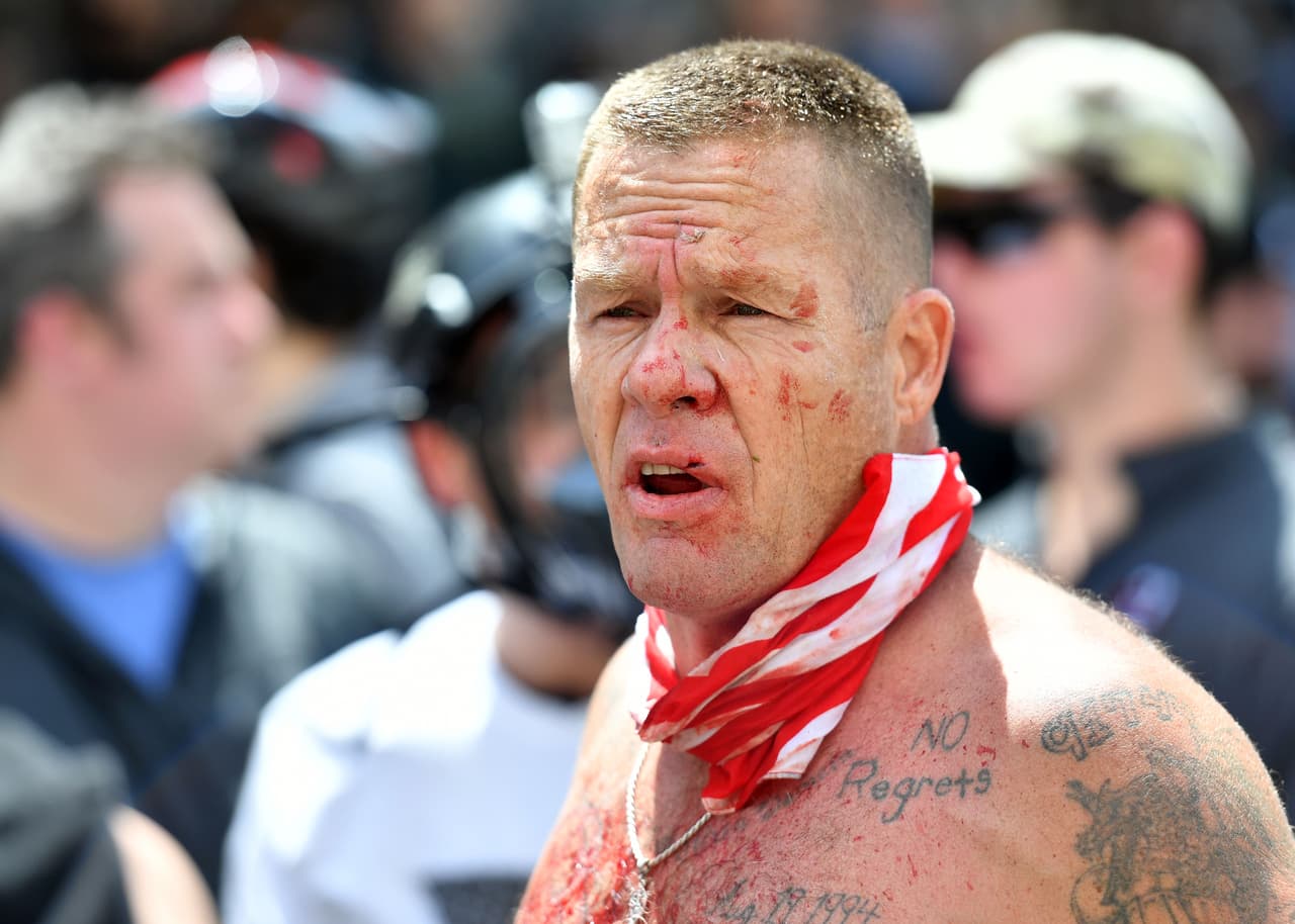 Otro de los lesionados en el encontronazo.