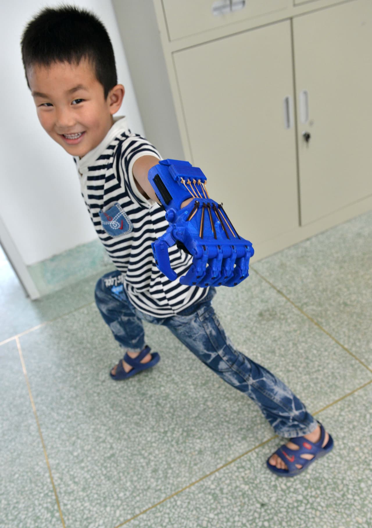 El pequeño de seis años tiene dos años viviendo sin sus cinco deditos.