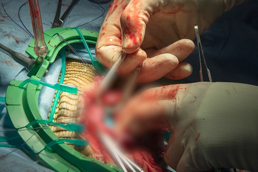 Este es el momento en que los especialistas del zoológico de Miami encuentran el termo en el estómago del dragón de Komodo.