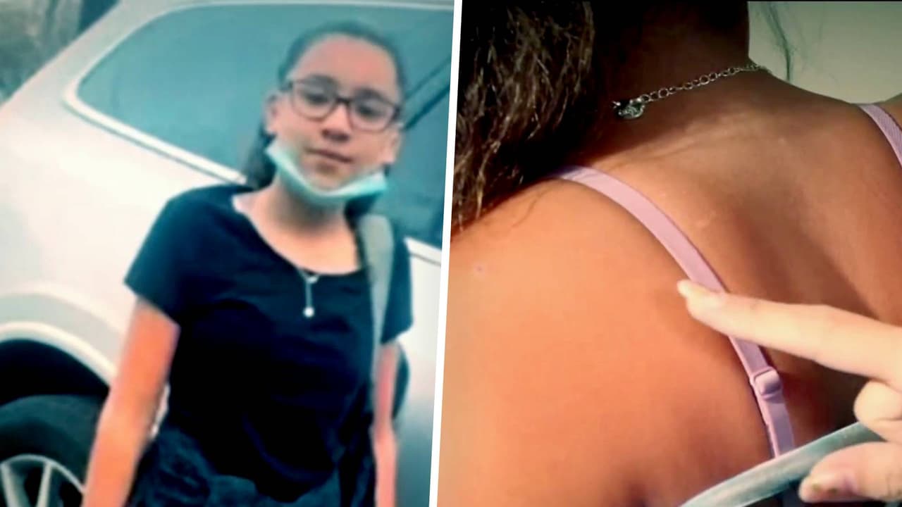 “La niña milagro”: sobreviviente de Uvalde muestra sus cicatrices y cuenta las veces que se ha salvado de la muerte