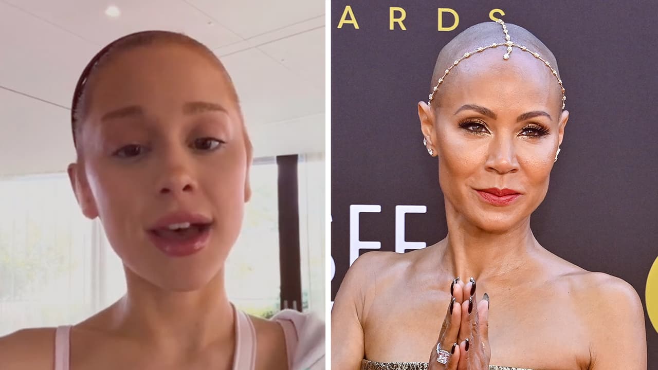 Estas famosas vivieron una pesadilla al perder su cabello, pero fueron valientes y revelaron su problema