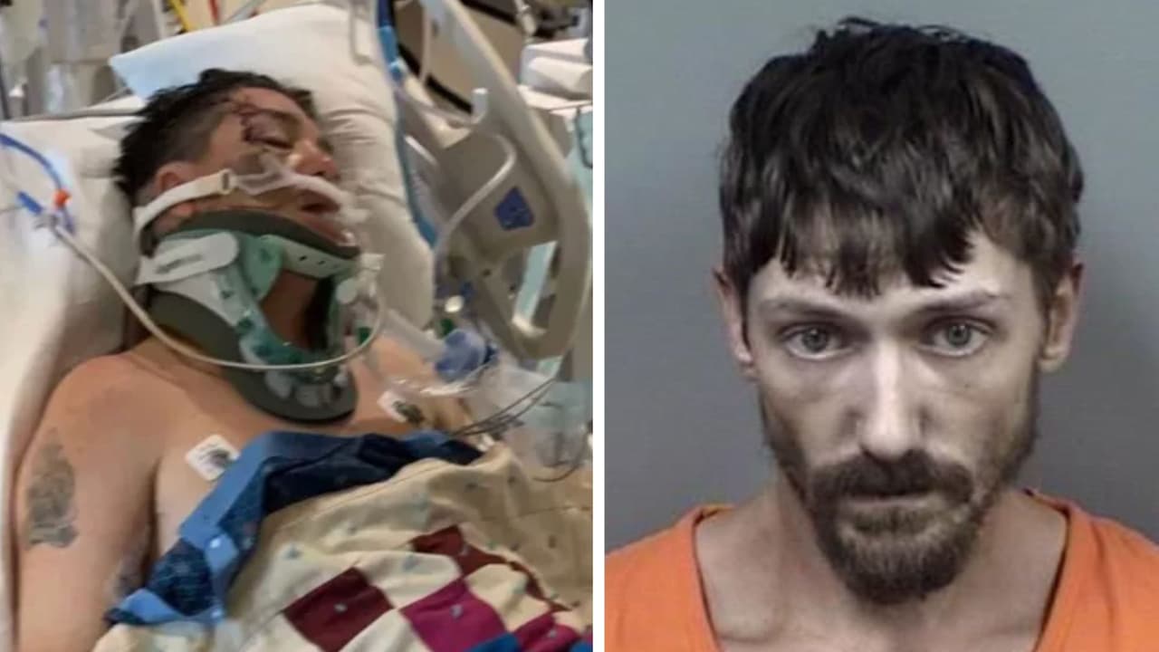 Hombre lucha por su vida tras accidente por ataque de ira en Florida