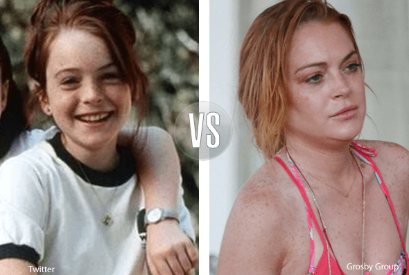Nada queda de la tierna Lindsay Lohan de 'Juego de Gemelas', los excesos en la vida de la actriz y cantante se ven reflejados en su rostro.