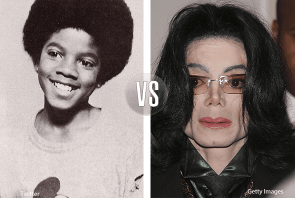 Michael Jackson era un tieno niño que supo cautivar con su voz y su talento, aunque de grande perdió parte de su encanto al someterse a constantes cirugías que prácticamente lo desfiguraron.