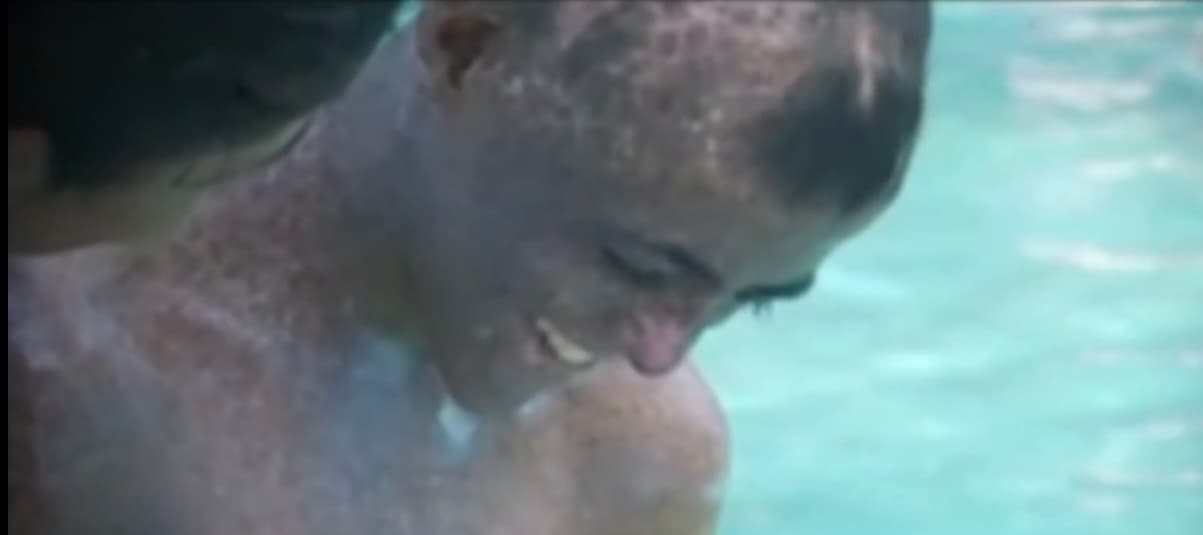 Sin embargo, pese a su deteriorado estado de salud con el cáncer expandido en todo su cuerpo, un viaje a la playa para conocer el mar le dio nuevos bríos al joven en medio de su incurable enfermedad. 
<b>Por eso, con 14 años cumplidos, cuatro más de los que se supone iba a vivir, Fernando tiene prohibido rendirse. </b>
<br>