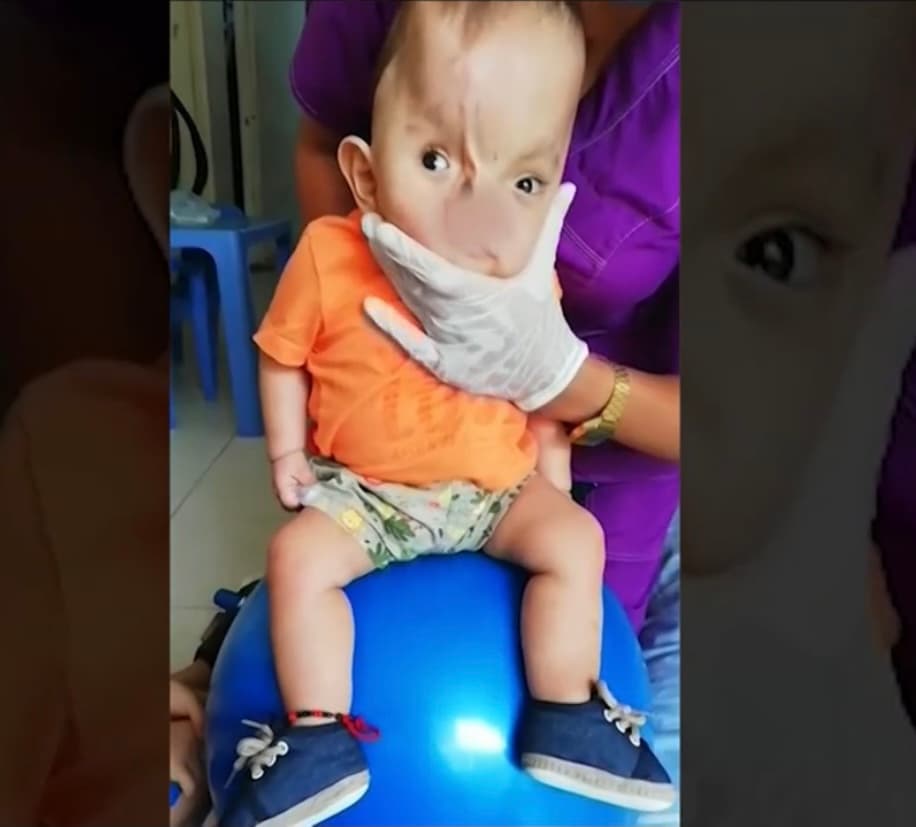 Con mucha esperanza y fe, Aguilar pide de corazón que le llegue el apoyo necesario para cubrir los gastos que tendrá que hacer con la finalidad de que el doctor Prieto pueda operar al niño de manera gratuita en 
<a href="https://www.univision.com/temas/california">California</a>. 
<b>“Toca pagar viajes, medicamentos y otras cosas”, dice la mujer. </b>
<br>