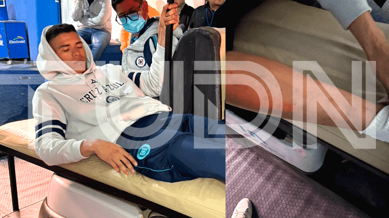 ¡Así quedó la pierna de Kevin Mier, tras fuerte entrada de Carrasquilla!